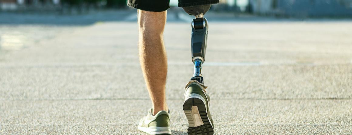 Photo of a man walking with one prosthetic leg.