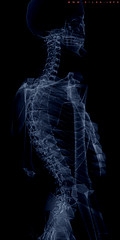 X-ray image link to story