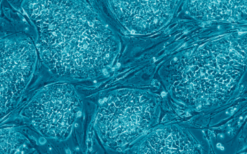 Human embryonic stem cells cropped (Images: Nissim Benvenisty)derivative work: Vojtech.dostal, CC BY 2.5 <https://creativecommons.org/licenses/by/2.5>, via Wikimedia Commons