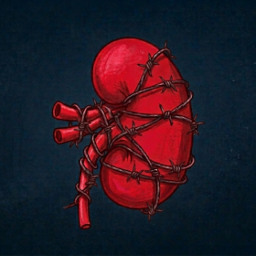 A drawing of a red kidney being strangled by barbed wire against a solid background. Generated by Sylvana Keeley Domokos using Gemini AI.