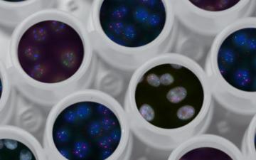 Close-up of genetic testing samples in circular containers. image link to story